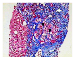The tissue section of liver injury stained