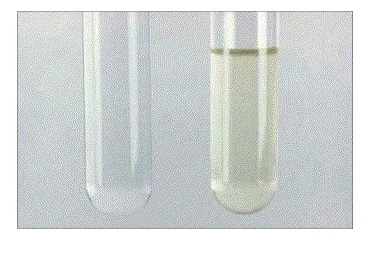 Inspection of the CSF visually exhibiting xanthochromia