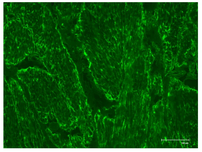 Positive Control Endomysial Antibody 