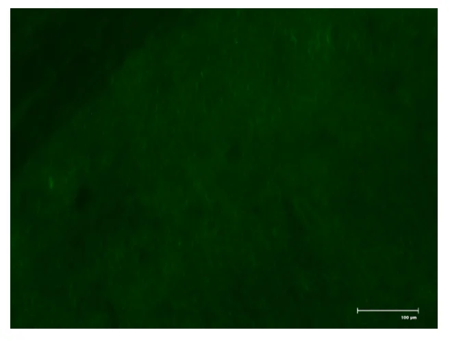 Negative Control Endomysial Antibody 