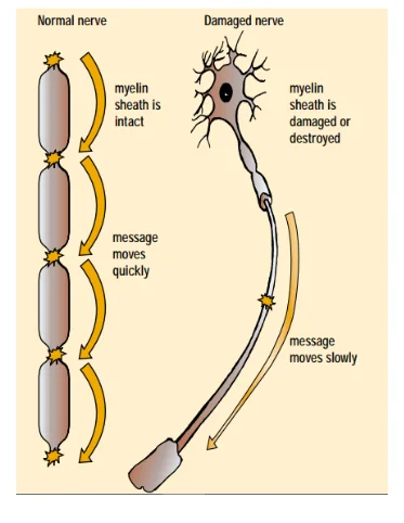 Role of myelin sheath in the speed of nerve impulse