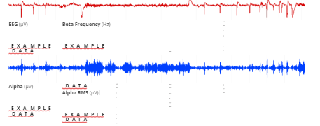 Alpha and beta rhythm