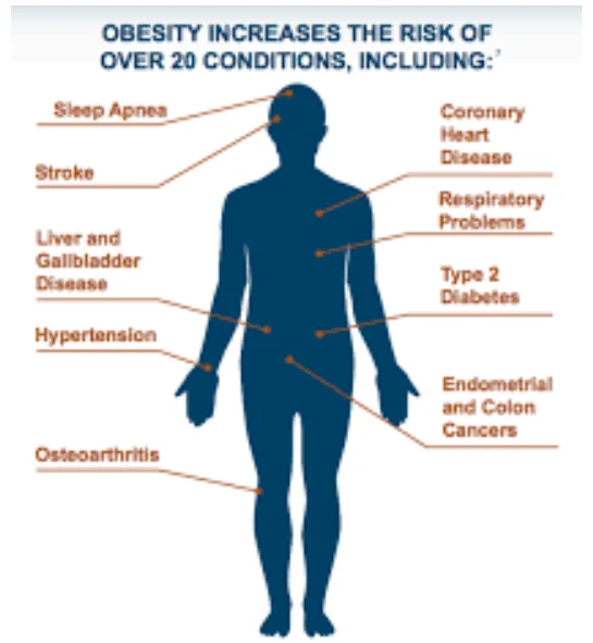 Risk of obesity