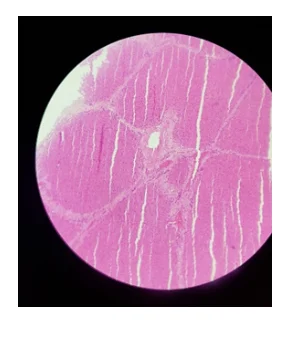 A section showing lamb liver stained with H&E, x100