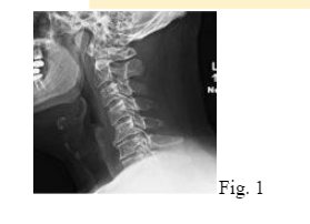 Physical exam
